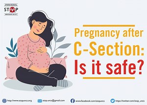 "Cesarean delivery might look easy to others but that’s as far from...