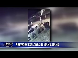 Video shows firework exploding in Lakeland man's hand