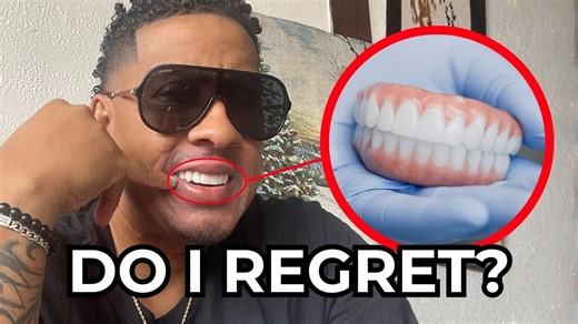 Do I Regret My Dental Implants? (1 Year Later - Honest Review) 😬🦷 - - - - - - - How Much Do Dental Implants Cost? Find out NOW: https://bit.ly/47Kh454 | Nuvia Dental Implant Center