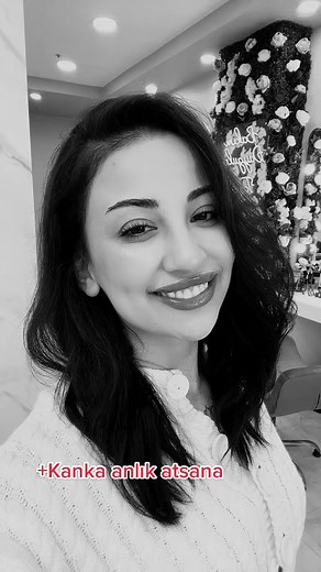 Buse Korkmaz'ın Estetiksiz Hali ve Hayatı