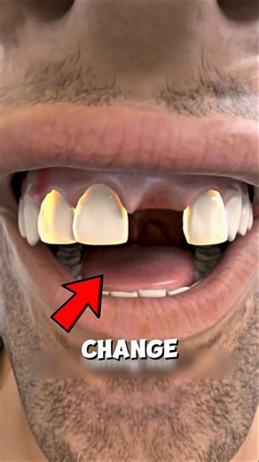 Why Baby Teeth Fall Out 😁 The Hidden Process Nobody Tells You