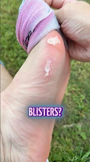 How to deal with blisters 🩹🦶 #football #soccer #tips #blisters #howto