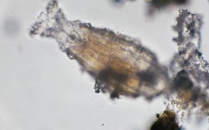 10-11月拍摄到的淡水微生物合集