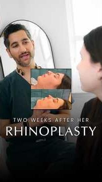 She's 2 weeks post-rhinoplasty!