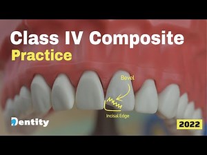 Class IV Composite Practice | حشوات الأسنان الأمامية عملي