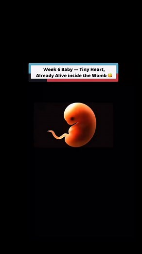 6 week baby #3DAnatomy #ultrasoundscan #babyusg #firsttrimester #fetus | Ade Femi