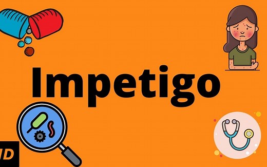 脓疱疮 - 病因，体征和症状，诊断和治疗