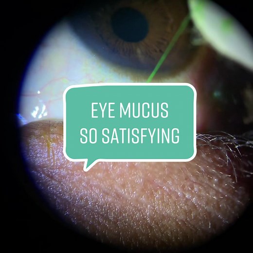 Eye Discharge Removal Tips and Tricks