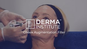 Cheek Augmentation Filler