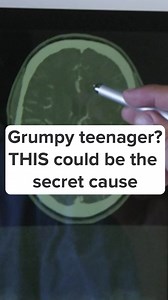 29K views · 622 reactions | Trouble sleeping...irritable...