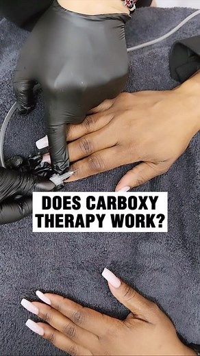 Doctor Ricky | Plastic Surgeon | Carboxytherapy is a non-surgical cosmetic treatment that involves the therapeutic use of carbon dioxide (CO2) gas. Here’s a breakdown: … 1.... | Instagram