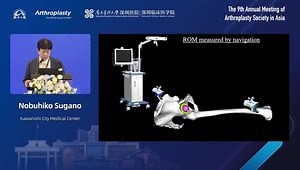 CT-Based Navigated THA