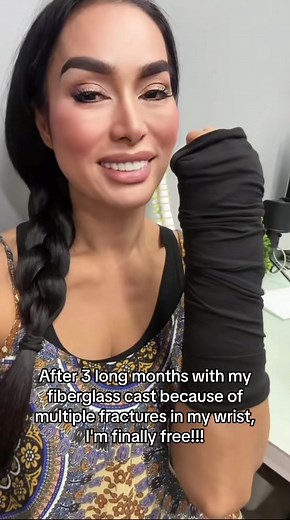 Recovering from Wrist Fractures: Finally Free After 3 Months!