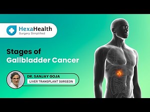 What are the stages of Gallbladder Cancer? || HexaHealth Expert