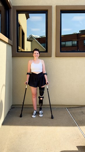 Bella takes her first steps with her new rotationplasty prosthesis! 🦿✨ Diagnosed with osteosarcoma, Bella opted for rotationplasty—a rare surgical procedure where her lower leg and foot were rotated 180° to allow her ankle to function as a knee. 🦾 ✈️Traveling all the way from Utah, Bella and her family spent a week with our NY team. On Day 1, she was cast and fitted with a diagnostic socket, and by Day 2, she got her final prosthesis. The rest of the week was spent training on different terrai