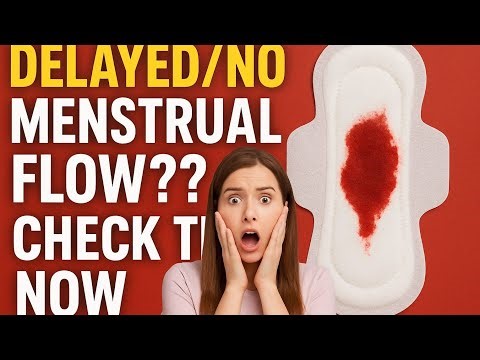 7 Major Causes Of Menstrual Flow Delayed In Women.