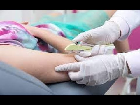 implanon description and insertion