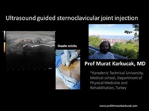 Ultrasound guided sternoclavicular joint injection