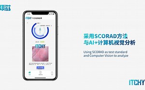 “抑滋ITCHY”一款采用SCORAD方法与AI+计算机视觉分析针对特应性皮炎的助手APP