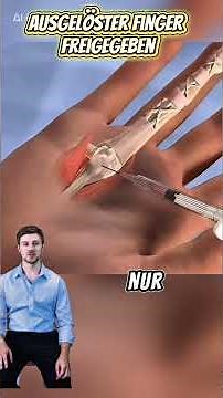 Schnappfinger: Die Lösung ist hier ✅🖐️