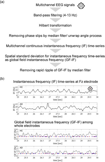 Atypical instantaneous spatio-temporal patterns of neural dynamics in Alzheimer’s disease - Scientific Reports