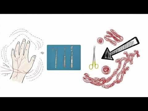 Surgical Instrumentation 101: Classification, Inspection, and Care for SPD Techs