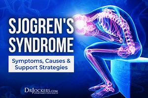 Sjogren’s Syndrome: Symptoms, Causes, and Natural Support Strategies