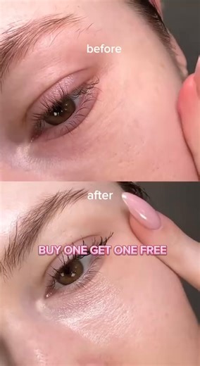 Dry, tired, wrinkle-prone skin? Not anymore. With Zyco HydraBalm, you’ll see real changes. Plump, fresh & youthful skin in days ✨ It’s not magic, it’s hydration done right 💦 🌸 Instantly smooth & hydrate 💧 Korean-inspired formula ✨ Works as moisturizer, primer, glow balm & on-the-go refresher 🎁 Limited Offer: Buy 1 Free 1! | Zyco HQ