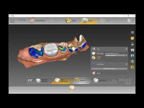 Crown Design Inlab Software 20