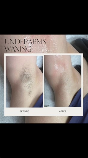 Look at those amazing before and after results from waxing.I use hard wax which requires no strips and less painfull. Follow the link to book your next appointment luxbeauty08.glossgenius.com #waxnesshardwax #underarmswaxing #femalebrazilianwax #hardwaxing #fullbodywaxing