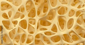 Developing of human bone osteoporosis spongy texture from normal to sick, time lapse 3d animation