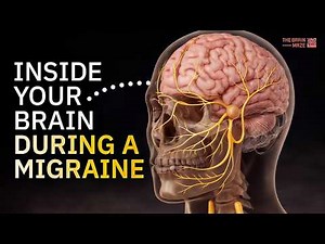 Inside Your Brain During a Migraine