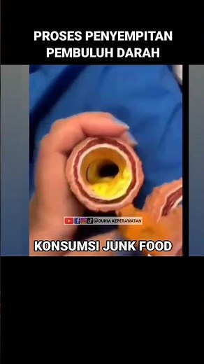 PROSES PENYEMPITAN PEMBULUH DARAH || DUNIA KEPERAWATAN