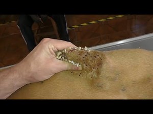 犬からワームを取り除くRemoving mangoworm in dog #23