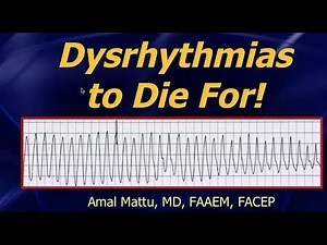 Dysrhythmias workshop