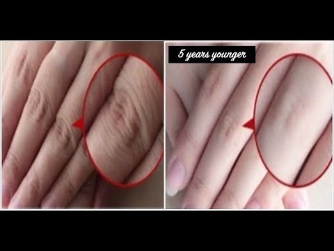 How to Make Your Hands Look 5 Years Younger Overnight! Wrinkle-free smooth fair hands