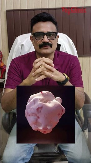 khatna ke fayde | Benefits of circumcision