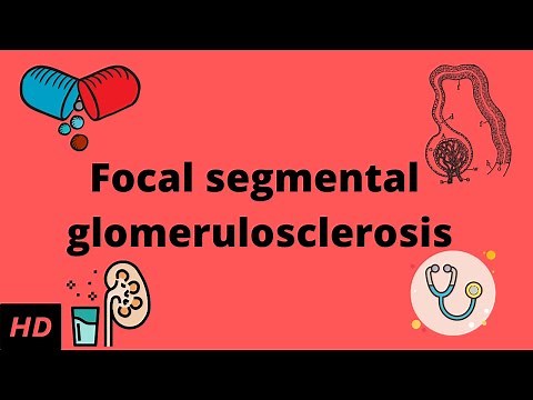Focal Segmental Glomerulosclerosis, Causes, Signs and Symptoms, Diagnosis and Treatment.