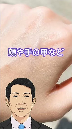 老人性色素斑の恐怖！長年の紫外線が刻む老け見えシミの正体と撃退法