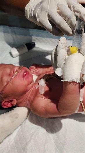 So baby injection in nicu 🥲💉👍 #youtubeshorts #trending #medical #nicureels #injection #nicu#babyboy