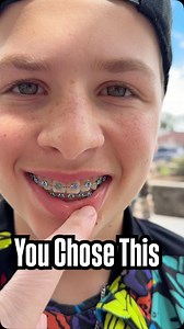 We took your suggestions. What colors should they get next? #braces #familyfunpack | Family Fun Pack