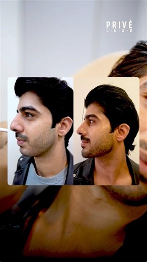 Can You Tell He Had Work Done? 🤔 (Male Face Sculpting)