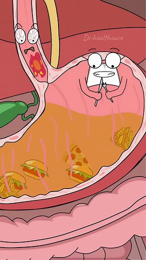 What actually causes acid reflux? | dr healthcare