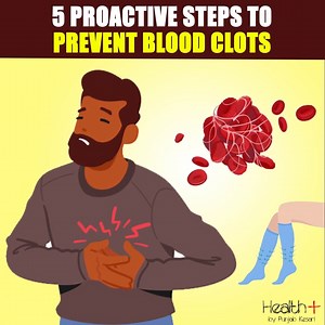 5 Proactive Steps to Prevent Blood Clots | Health