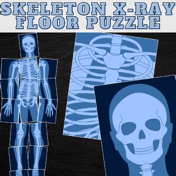 Skeleton X-Ray Puzzle Skeletal System Puzzle, Human Body System Puzzle Printable