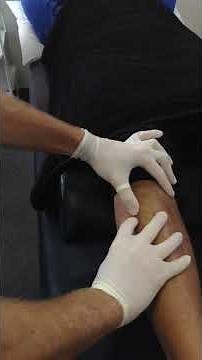 Extensor Digitorum Longus Dry Needling