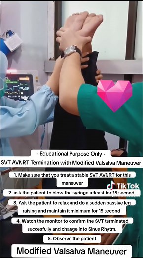 SVT AVNRT Termination with Modified Valsalva Maneuver