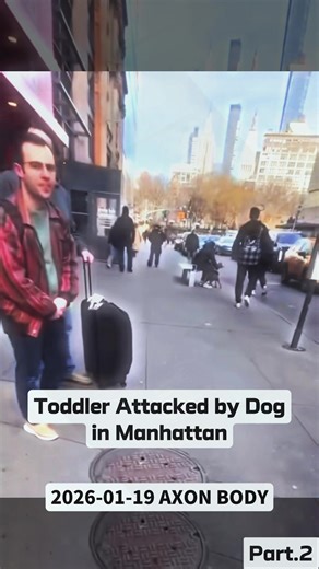An innocent child was attacked by a dog right on the street in NYC. The dog grabbed on and would not let go.