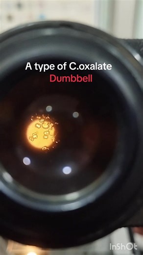 Calcium Oxalate Crystals Under the Microscope