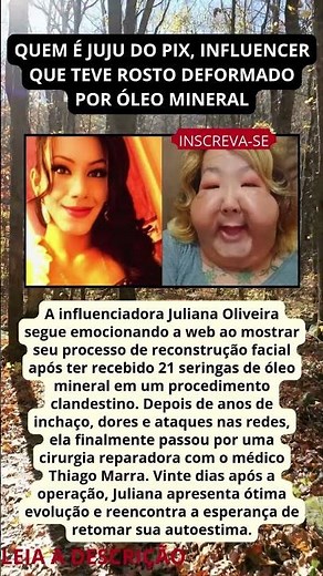 QUEM É JUJU DO PIX, INFLUENCER QUE TEVE ROSTO DEFORMADO POR ÓLEO MINERAL
